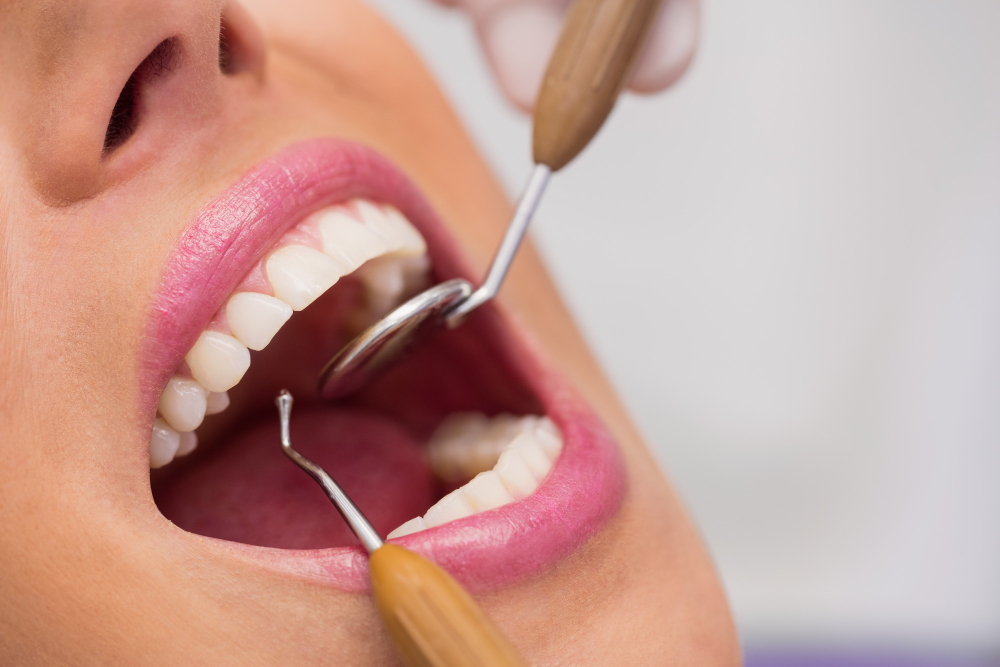 melhorar o sorriso com os dentes